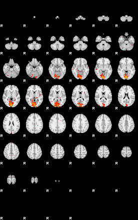 Patients 28935 7