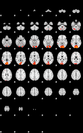 Patients 29096 10