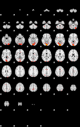 Patients 29190 12