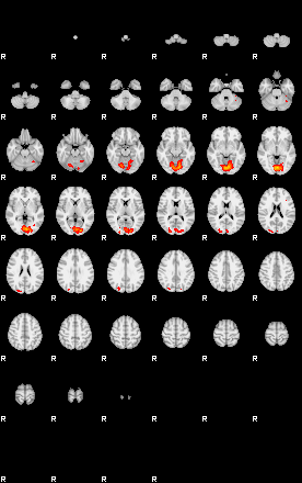 Patients 29434 135