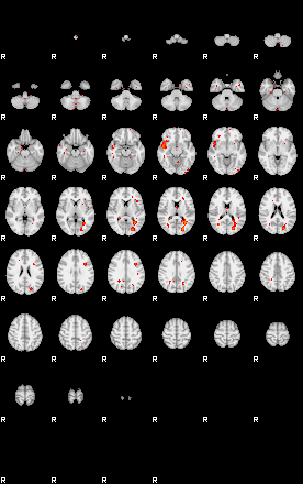 Patients 28690 47