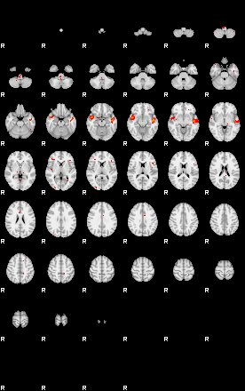 Patients 28691 77