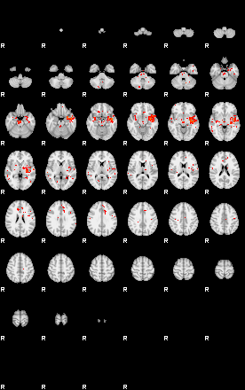 Patients 28930 199