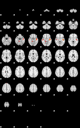 Patients 29070 137