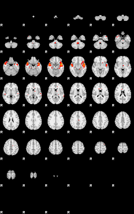 Patients 29103 1