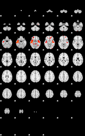 Patients 29110 21