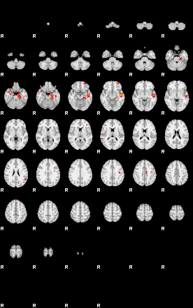 Patients 29113 200