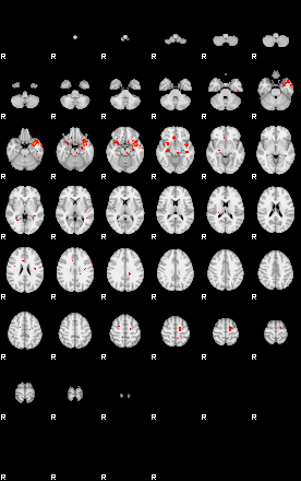 Patients 29152 178