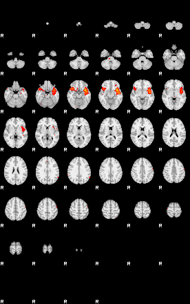 Patients 29158 1