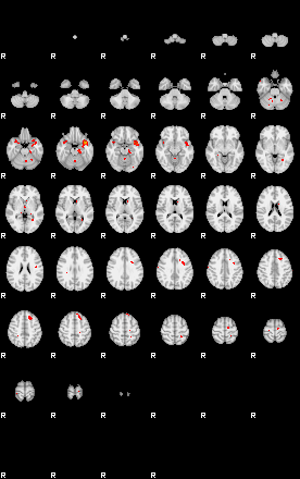 Patients 29168 179