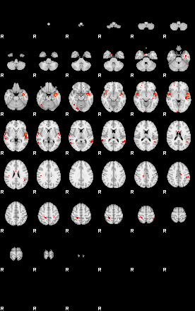 Patients 29169 140