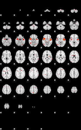 Patients 29179 30