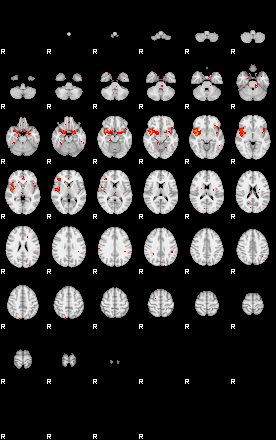 Patients 29181 181