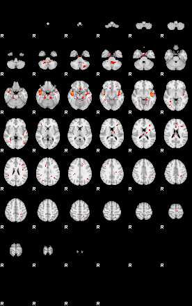 Patients 29190 124