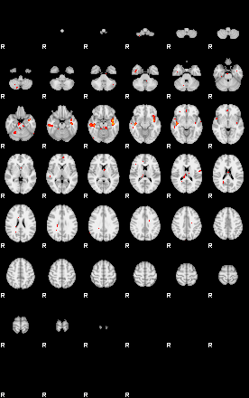 Patients 29201 16