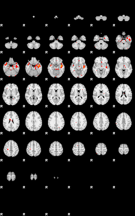 Patients 29221 17