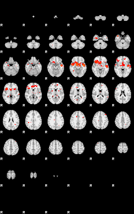 Patients 29223 138