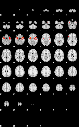 Patients 29274 105