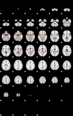 Patients 29285 192