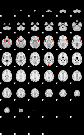 Patients 29435 1