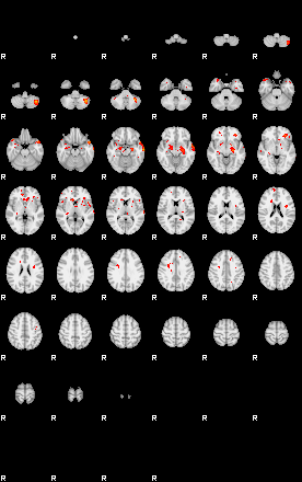 Patients 29449 50