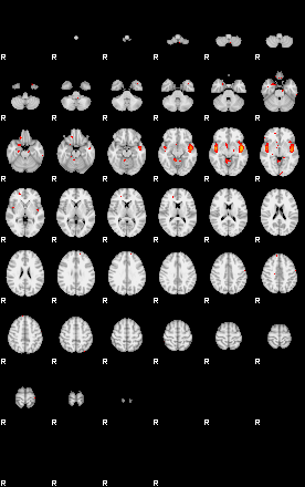 Patients 29661 92