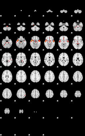 Patients 29671 200