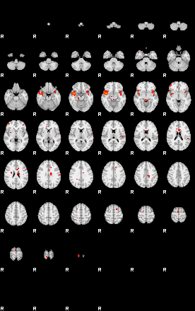 Patients 29733 1