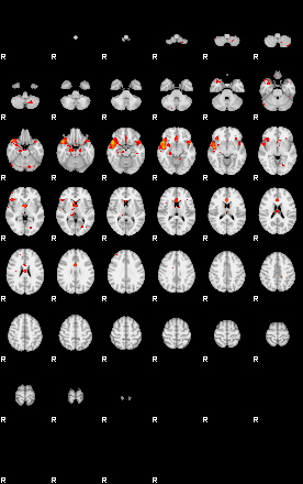 Patients 29736 1