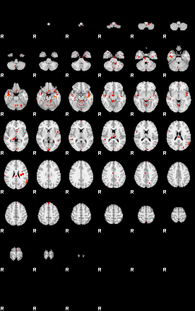 Patients 29881 3