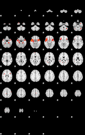 Patients 30018 2