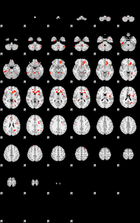 Patients 28681 21