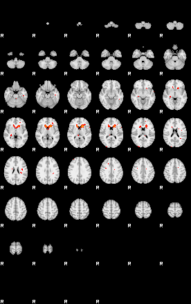 Patients 29152 182