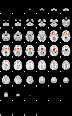 Patients 29168 195