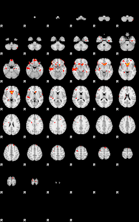 Patients 29415 3