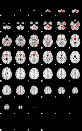 Patients 29509 170