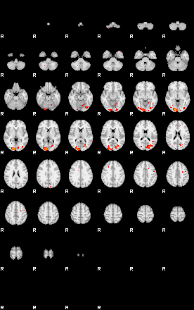 Patients 29186 171