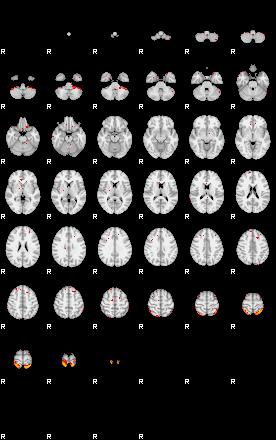 Patients 29006 127