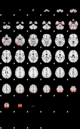 Patients 29055 167