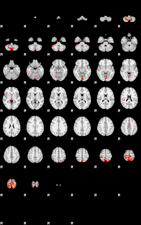 Patients 29097 191