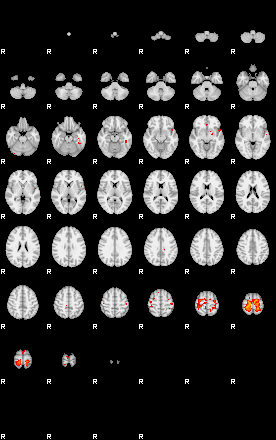 Patients 29110 33