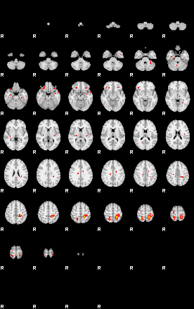 Patients 29172 154