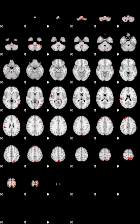 Patients 29183 18