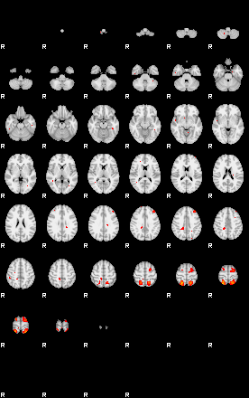 Patients 29189 150