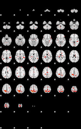 Patients 29204 148