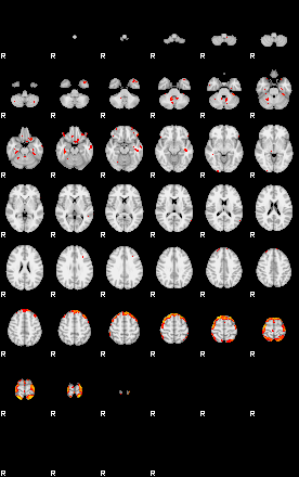 Patients 29281 139