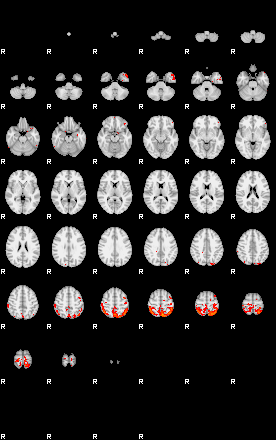 Patients 29391 96