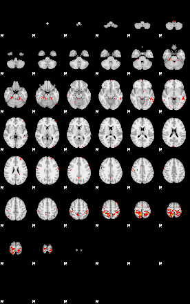 Patients 29503 184