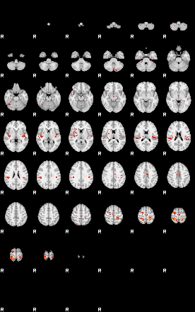 Patients 29539 141