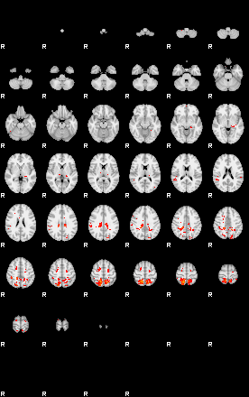 Patients 30027 60